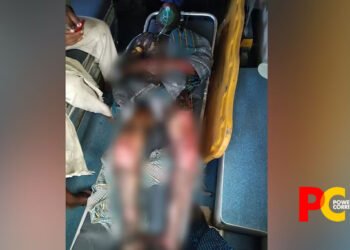 Andhra Pradesh teen dies after classmate sets him on fire