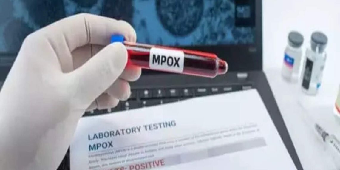 Mpox Outbreak: WHO approves first diagnosis testing kit