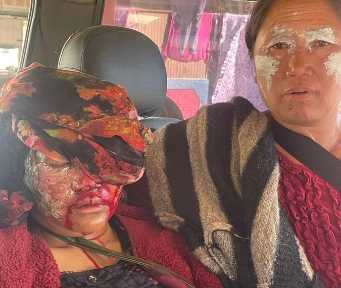 Tragedy in Saibol: Dozens of Kuki-zo women injured