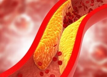 When cholestrol gets bad..it gets too bad