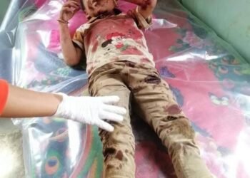 Landmine victim in Myanmar