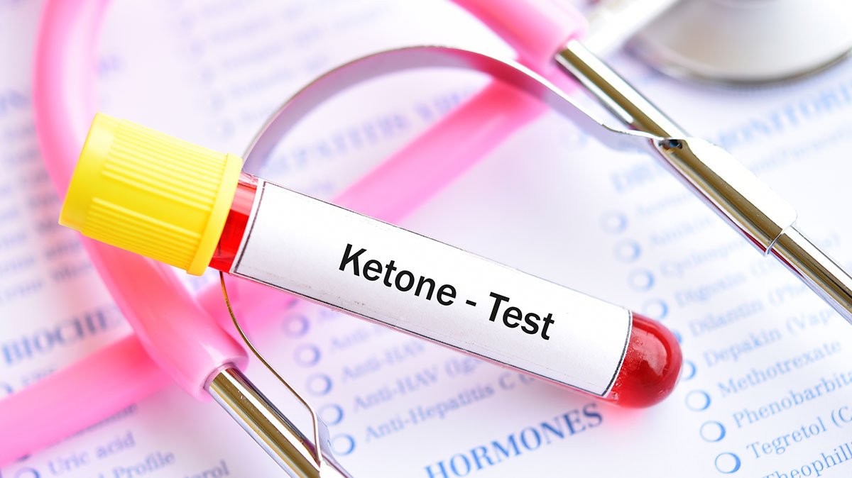 Diabetic Ketoacidosis