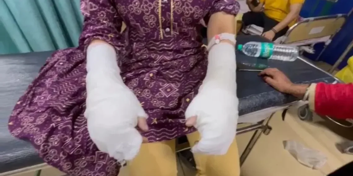 Delhi Acid Attack Twist: Survivor’s Father Confesses to Plotting the Assault